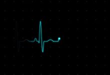 VideoHive EKG (Heartbeat Monitor - Electrocardiogram) 615689