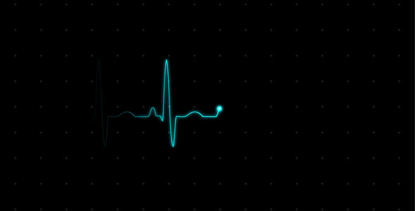 VideoHive EKG (Heartbeat Monitor - Electrocardiogram) 615689