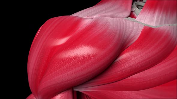 VideoHive Shoulder Injury With L Shaped Tear Of The Rotator Cuff 34256450