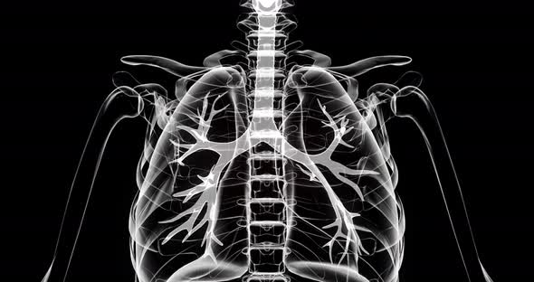 VideoHive Lung disease. Inflammation of the lungs in humans. X-ray of a person on a black background 38987867